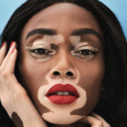 Winnie Harlow Net Worth | Wiki, Biography, Career, Skin, Parents, Relationship